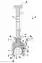 Fig. 01 - Securement device for an orthopedic prosthesis, thermal treatment device for an orthopedic prosthesis, and methods of use