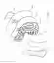 Fig. 07 - Welded back brace