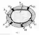 Fig. 03 - HUMAN RESTRAINT DEVICE