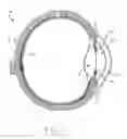 Fig. 02 - Intraocular implant device