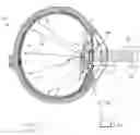 Fig. 06 - Intraocular implant device