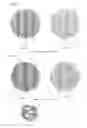 Fig. 05 - Cylindrical bandage