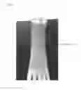 Fig. 18 - Cylindrical bandage