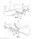 Fig. 12 - Patient positioning and support system