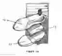 Fig. 02 - Method and apparatus for improving human balance and gait and preventing foot injury