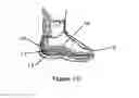 Fig. 03 - Method and apparatus for improving human balance and gait and preventing foot injury