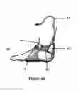 Fig. 10 - Method and apparatus for improving human balance and gait and preventing foot injury