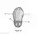 Fig. 12 - Method and apparatus for improving human balance and gait and preventing foot injury