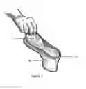 Fig. 16 - Method and apparatus for improving human balance and gait and preventing foot injury
