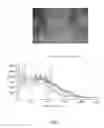 Fig. 04 - PRODUCT COMPRISING HYDROLIZED COLLAGEN AND AT LEAST ONE AMORPHOUS MICRONIZED DRUG, PROCESS FOR THE PREPARATION THEREOF AND RELATED USES IN MEDICAL FIELD