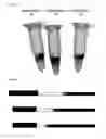 Fig. 06 - Nucleic acid-containing lipid nanoparticles