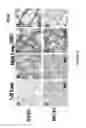 Fig. 10 - COMPOSITIONS AND METHODS FOR TREATING LUNG DISEASES