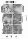 Fig. 13 - COMPOSITIONS AND METHODS FOR TREATING LUNG DISEASES