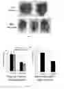 Fig. 20 - COMPOSITIONS AND METHODS FOR TREATING LUNG DISEASES
