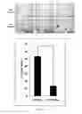 Fig. 21 - COMPOSITIONS AND METHODS FOR TREATING LUNG DISEASES
