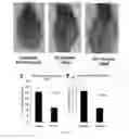 Fig. 27 - COMPOSITIONS AND METHODS FOR TREATING LUNG DISEASES