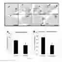 Fig. 28 - COMPOSITIONS AND METHODS FOR TREATING LUNG DISEASES