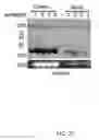 Fig. 06 - METHODS AND COMPOSITIONS RELATING TO PROTEASOME INHIBITOR RESISTANCE