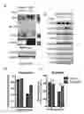 Fig. 11 - METHODS AND COMPOSITIONS RELATING TO PROTEASOME INHIBITOR RESISTANCE