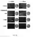 Fig. 15 - METHODS AND COMPOSITIONS RELATING TO PROTEASOME INHIBITOR RESISTANCE