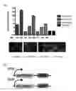 Fig. 18 - METHODS AND COMPOSITIONS RELATING TO PROTEASOME INHIBITOR RESISTANCE