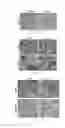 Fig. 06 - Method for using small molecule compounds to induce human tumor cells to be directly reprogrammed into non-oncogenic cells