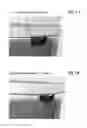 Fig. 02 - Compositions and Methods of Treating Muscular Dystrophy with Thromboxane-A2 Receptor Antagonists