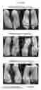 Fig. 08 - METHODS OF TREATING KERATIN HYPERPROLIFERATION DISORDERS USING mTOR INHIBITORS