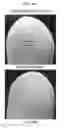 Fig. 09 - METHODS OF TREATING KERATIN HYPERPROLIFERATION DISORDERS USING mTOR INHIBITORS