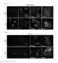 Fig. 08 - Methods of sensitizing tumor cells to weak base chemotherapeutic drugs