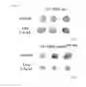 Fig. 49 - Methods of sensitizing tumor cells to weak base chemotherapeutic drugs
