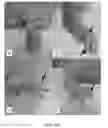 Fig. 22 - Phosphorylcholine conjugates and uses thereof
