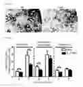 Fig. 12 - Method for preventing or treating influenza virus infection using pharmaceutical composition comprising immunoglobulin Fc-fused interleukin-7 fusion protein