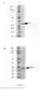 Fig. 05 - CLOSTRIDIUM DIFFICILE BACTERIOPHAGE LYSINS FOR DETECTION AND TREATMENT OF CLOSTRIDIUM DIFFICILE BACTERIA INFECTION