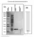 Fig. 04 - Mitrecin a polypeptide with antimicrobial activity