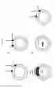 Fig. 02 - Immunogenic compositions containing bacterial outer membrane vesicles and therapeutic uses thereof