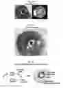 Fig. 02 - LENS REGENERATION USING ENDOGENOUS STEM/PROGENITOR CELLS