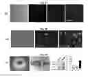 Fig. 08 - LENS REGENERATION USING ENDOGENOUS STEM/PROGENITOR CELLS