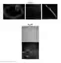 Fig. 14 - LENS REGENERATION USING ENDOGENOUS STEM/PROGENITOR CELLS