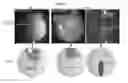 Fig. 25 - LENS REGENERATION USING ENDOGENOUS STEM/PROGENITOR CELLS
