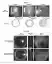 Fig. 26 - LENS REGENERATION USING ENDOGENOUS STEM/PROGENITOR CELLS