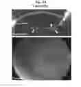 Fig. 27 - LENS REGENERATION USING ENDOGENOUS STEM/PROGENITOR CELLS