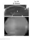 Fig. 28 - LENS REGENERATION USING ENDOGENOUS STEM/PROGENITOR CELLS