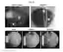 Fig. 33 - LENS REGENERATION USING ENDOGENOUS STEM/PROGENITOR CELLS