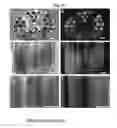 Fig. 37 - LENS REGENERATION USING ENDOGENOUS STEM/PROGENITOR CELLS