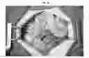 Fig. 06 - PATCH GRAFT COMPOSITIONS FOR CELL ENGRAFTMENT