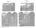Fig. 08 - PATCH GRAFT COMPOSITIONS FOR CELL ENGRAFTMENT