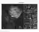 Fig. 12 - PATCH GRAFT COMPOSITIONS FOR CELL ENGRAFTMENT