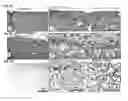 Fig. 17 - PATCH GRAFT COMPOSITIONS FOR CELL ENGRAFTMENT