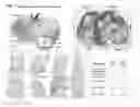Fig. 20 - PATCH GRAFT COMPOSITIONS FOR CELL ENGRAFTMENT
